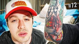 Thumbnail for He got hospitalized by a Tattoo Infection. | The Yard